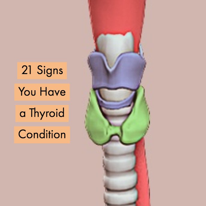 signs-of-a-thyroid-condition-thyroid-nutrition-educators