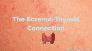 The Eczema Thyroid Connection: Research & Personal Experiences ...